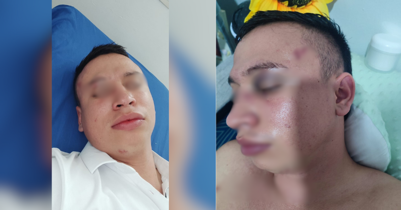 Ciudadano denuncia presunto abuso policial en Mari