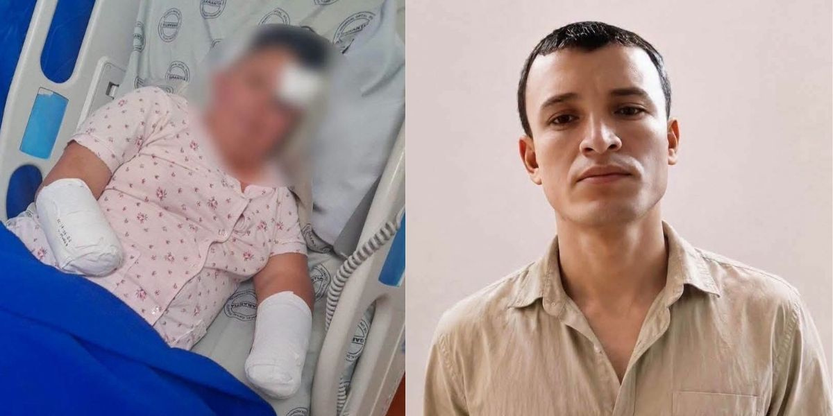 Urely perdió ambas manos tras brutal ataque de un